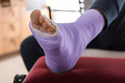 Foot and ankle Fractures treatment in the Wayne County, MI: Detroit (Hamtramck, River Rouge, Dearborn, Melvindale, Highland Park, Grosse Pointe Park, Grosse Pointe, Lincoln Park, Allen Park, Redford Charter Twp)